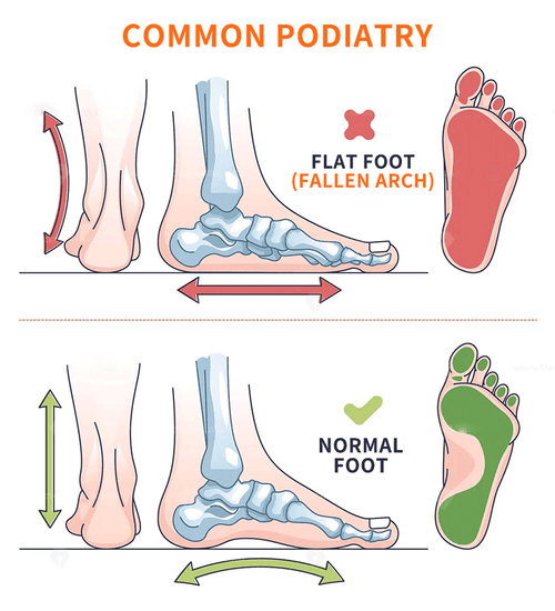Grounded Adaptive Insole