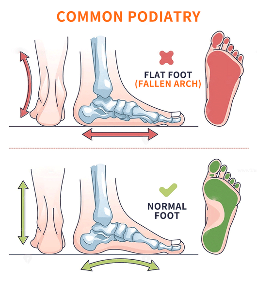 Grounded Adaptive Insole
